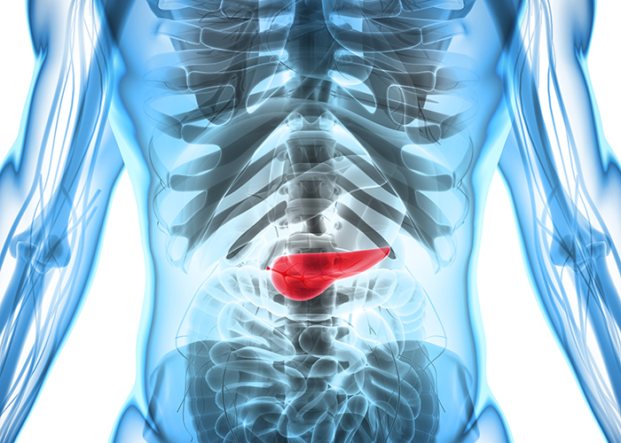 Pancreatic Cancer 3d render