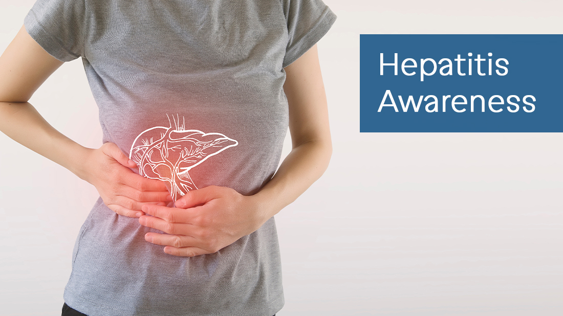 Woman suffering from hepatitis